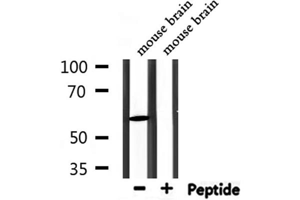 PDP2 anticorps  (N-Term)