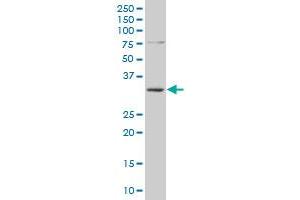 SMUG1 polyclonal antibody (A01), Lot # 060608JCS1 Western Blot analysis of SMUG1 expression in SJCRH30 . (SMUG1 antibody  (AA 2-78))