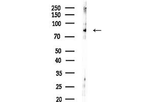 Western blot analysis of lysates from HepG2 cells(LPS,4h treatment), using Z Antibody at 1/1000 dilution.