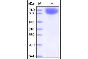 Human Vasorin, His Tag on SDS-PAGE under reducing (R) condition. (Vasn Protein (AA 24-575) (His tag))
