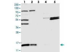 Western blot analysis of Lane 1: RT-4, Lane 2: U-251 MG, Lane 3: Human Plasma, Lane 4: Liver, Lane 5: Tonsil with FAM136A polyclonal antibody  at 1:250-1:500 dilution.