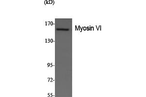 Western Blotting (WB) image for anti-Myosin VI (MYO6) antibody (ABIN5958676) (Myosin VI antibody)