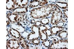 Immunohistochemistry (IHC) image for anti-Induced Myeloid Leukemia Cell Differentiation Protein Mcl-1 (MCL1) antibody (ABIN1499341) (MCL-1 antibody)