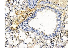 ABIN7096583 and ABIN7100647 at 1/100 staining mouse lung tissue by IHC-P. (RUFY3 antibody)