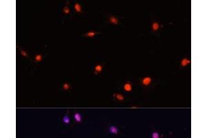 Immunofluorescence (IF) image for anti-Minichromosome Maintenance Complex Component 5 (MCM5) antibody (ABIN7257096)