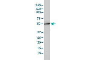 ACY1 monoclonal antibody (M01), clone 4F1-B7. (Aminoacylase 1 antibody  (AA 1-408))