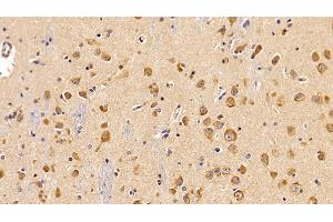 Immunohistochemistry (IHC) image for anti-Leptin Receptor (LEPR) (AA 310-539) antibody (ABIN7430873)