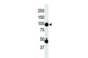 Western Blotting (WB) image for anti-Mitogen-Activated Protein Kinase Kinase Kinase Kinase 2 (MAP4K2) antibody (ABIN2971016) (MAP4K2 antibody)