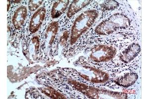 Immunohistochemical analysis of paraffin-embedded human-colon, antibody was diluted at 1:100. (FOXP3 antibody  (C-Term))