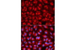 Immunofluorescence analysis of U2OS cells using TFAM antibody (ABIN5970991). (TFAM antibody)