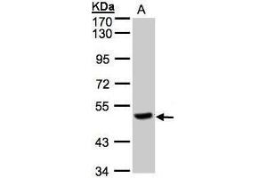 WB Image Sample(30 μg of whole cell lysate) A:Raji, 7. (CPQ antibody)