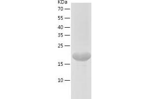 Western Blotting (WB) image for Calcium And Integrin Binding Family Member 2 (CIB2) (AA 1-187) protein (His tag) (ABIN7284646) (CIB2 Protein (AA 1-187) (His tag))