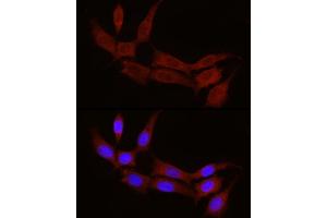 Immunofluorescence analysis of NIH/3T3 cells using STX17 Rabbit pAb (ABIN7270682) at dilution of 1:100 (40x lens). (Syntaxin 17 antibody  (AA 1-130))