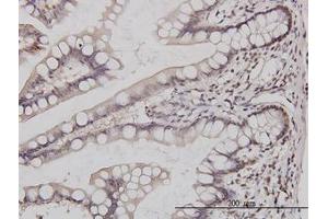 Image no. 2 for anti-GA Binding Protein Transcription Factor, alpha Subunit 60kDa (GABPA) (AA 1-101) antibody (ABIN598704) (GABPA antibody  (AA 1-101))