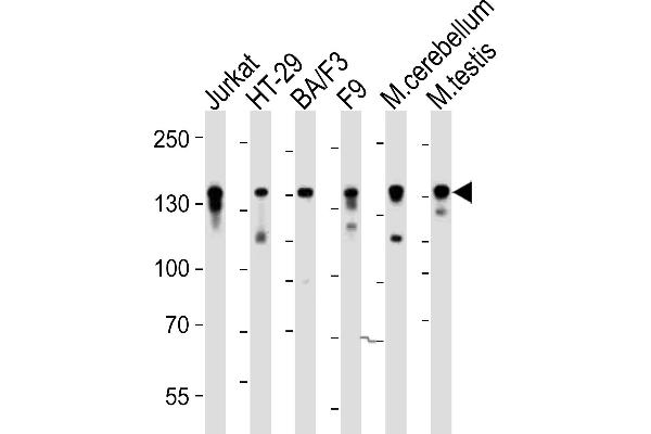 CTR9 antibody  (C-Term)