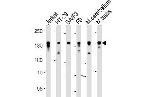 Western blot analysis of lysates from Jurkat, HT-29, mouse BA/F3, mouse F9 cell line, mouse cerebellum, mouse testis tissue (from left to right), using Mouse Ctr9 Antibody (C-term) (ABIN6243851 and ABIN6577807).