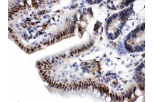 Visfatin was detected in paraffin-embedded sections of rat intestine tissues using rabbit anti- Visfatin Antigen Affinity purified polyclonal antibody (Catalog # ) at 1 µg/mL. (NAMPT antibody  (AA 62-337))