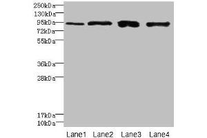 Western blot All lanes: XRRA1 antibody at 6 μg/mL Lane 1: HepG2 whole cell lysate Lane 2: Mouse kidney tissue Lane 3: HL60 whole cell lysate Lane 4: U251 whole cell lysate Secondary Goat polyclonal to rabbit IgG at 1/10000 dilution Predicted band size: 90, 68, 89, 84, 59 kDa Observed band size: 90 kDa (XRRA1 antibody  (AA 101-400))
