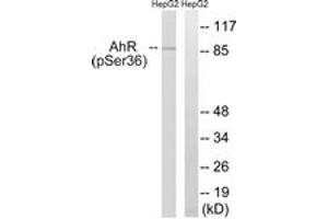 Western blot analysis of extracts from HepG2 cells, using AhR (Phospho-Ser36) Antibody. (Aryl Hydrocarbon Receptor antibody  (pSer36))
