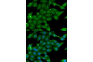 Immunofluorescence analysis of U20S cell using RASGRF1 antibody. (RASGRF1 antibody)