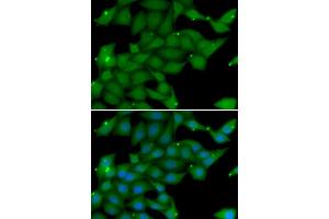 Immunofluorescence analysis of U20S cell using RASGRF1 antibody. (RASGRF1 antibody)
