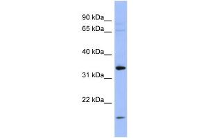 WB Suggested Anti-PYCR1  Antibody Titration: 0. (PYCR1 antibody  (Middle Region))