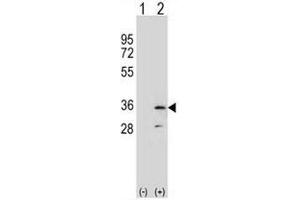 Western blot analysis of RPA2 (arrow) using rabbit polyclonal RPA2 Antibody (N-term) . (RPA2 antibody  (N-Term))