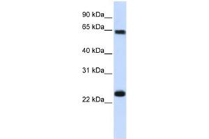 Karyopherin Alpha 1 antibody used at 1 ug/ml to detect target protein.