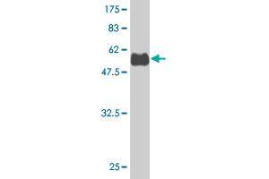 Western Blot detection against Immunogen (53. (SNX29 antibody  (AA 1-249))
