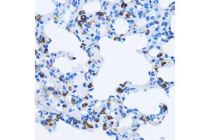 Immunohistochemistry of paraffin-embedded Rat lung using EE antibody  at dilution of 1:100 (40x lens).