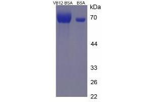 Image no. 2 for Vitamin B12 protein (BSA) (ABIN1880114)