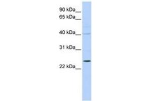 Image no. 1 for anti-Kv Channel Interacting Protein 2 (KCNIP2) (N-Term) antibody (ABIN6742581) (KCNIP2 antibody  (N-Term))