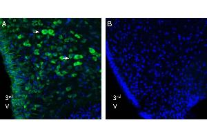 Expression of Nucleobindin-2/Nesfatin-1 in rat hypothalmus. (Nucleobindin 2 (NUCB2) Peptide)