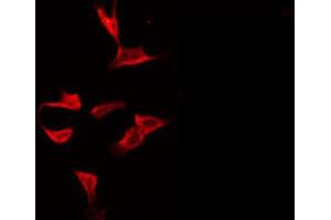 ABIN6272429 staining HeLa by IF/ICC. (Septin 8 antibody  (Internal Region))
