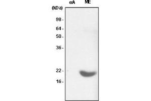 Western Blotting (WB) image for anti-Crystallin, alpha B (CRYAB) (AA 1-175) antibody (ABIN6245677) (CRYAB antibody  (AA 1-175))