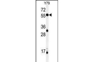 Western blot analysis of NOB1 Antibody (C-term) (ABIN651015 and ABIN2840039) in Y79 cell line lysates (35 μg/lane). (NOB1 antibody  (C-Term))