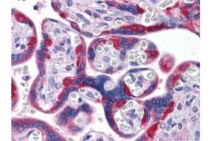 Immunohistochemical analysis of paraffin-embedded human Placenta tissues using PEG10 antibody (PEG10 antibody)