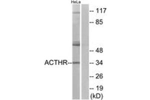 Western Blotting (WB) image for anti-Melanocortin 2 Receptor (Adrenocorticotropic Hormone) (MC2R) (AA 248-297) antibody (ABIN2890808) (MC2R antibody  (AA 248-297))