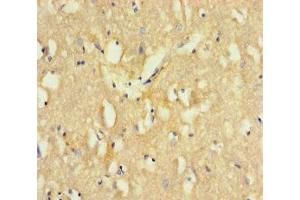Immunohistochemistry of paraffin-embedded human brain tissue using ABIN7171199 at dilution of 1:100 (Sorting Nexin 1 antibody  (AA 1-250))