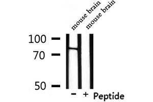 Western blot analysis of extracts from mouse brain, using NOL11 Antibody. (NOL11 antibody)