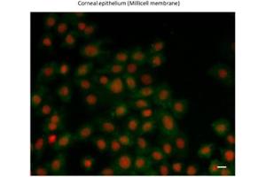 Immunofluorescence (IF) image for anti-Zinc Finger E-Box Binding Homeobox 1 (ZEB1) (N-Term) antibody (ABIN2779631)