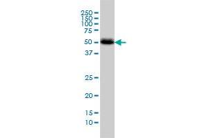 CANT1 monoclonal antibody (M01), clone 2D3 Western Blot analysis of CANT1 expression in A-431 . (CANT1 antibody  (AA 302-401))