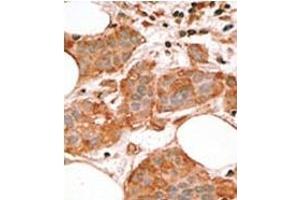 Image no. 2 for anti-BCL2-Like 14 (Apoptosis Facilitator) (BCL2L14) (BH3 Domain), (Isoform 3) antibody (ABIN356813) (BCL2L14 antibody  (BH3 Domain, Isoform 3))