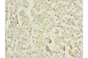 Immunohistochemistry of paraffin-embedded human liver tissue using ABIN7148369 at dilution of 1:100 (C8A antibody  (AA 310-460))