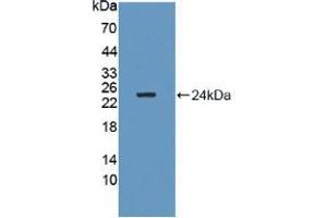 Figure. (GM2A antibody  (AA 24-193))