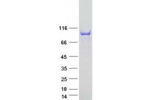 Ankyrin Repeat and SAM Domain-Containing Protein 3 (ANKS3) protein (Myc-DYKDDDDK Tag)