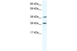 Western Blotting (WB) image for anti-Myocyte Enhancer Factor 2B (MEF2B) antibody (ABIN2461444) (MEF2B antibody)