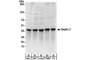 Western Blotting (WB) image for anti-Septin 2 (SEPT2) (AA 275-325) antibody (ABIN7450720)
