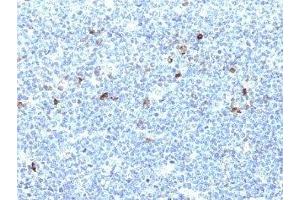 Formalin-fixed, paraffin-embedded human tonsil stained with HLA-Aw32 / HLA-A25 antibody (CATA-1). (HLA-Aw32-&-HLA-A25 (MHC-I) antibody)