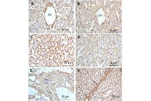 Immunohistochemistry (IHC) image for anti-Collagen, Type I (COL1) antibody (ABIN5596819)